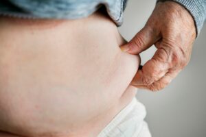 Person pinching body fat on stomach