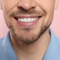 photo of man's smile and teeth