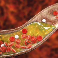 3D represntation of cholesterol in blood stream