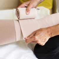 Bandages legs and manual lymphatic drainage massage for a patient with swelling effect