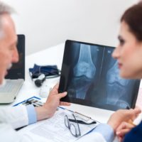 Doctor showing a radiography to his patient and diagnosing osteoporosis