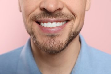 photo of man's smile and teeth