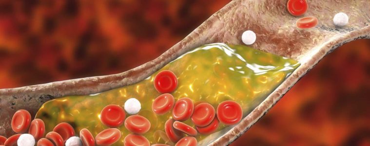 3D represntation of cholesterol in blood stream